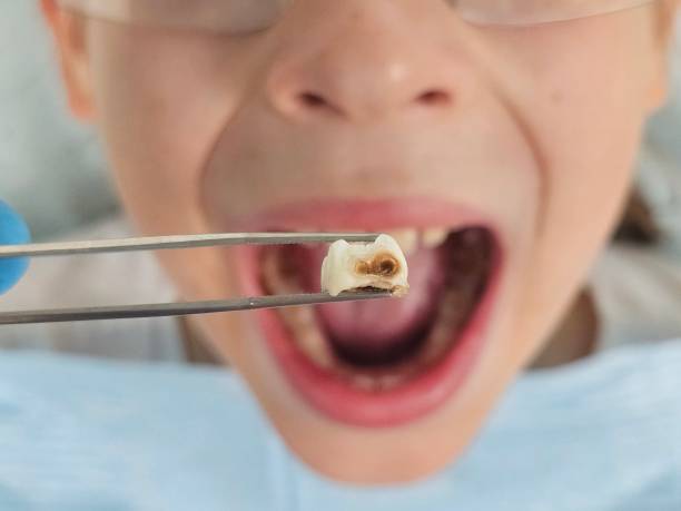 Best Pediatric Emergency Dentist in Gettysburg, SD